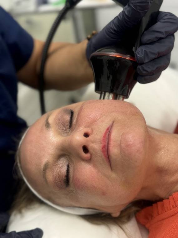 TriLift treatment at Zenskinsation