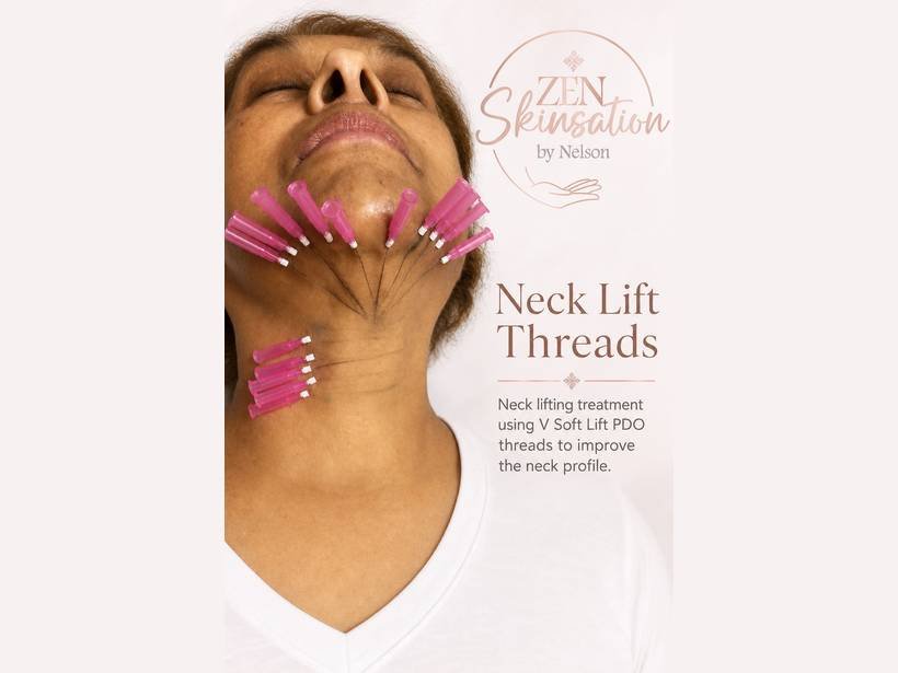 Neck Lift PDO Threads at Zenskinsation