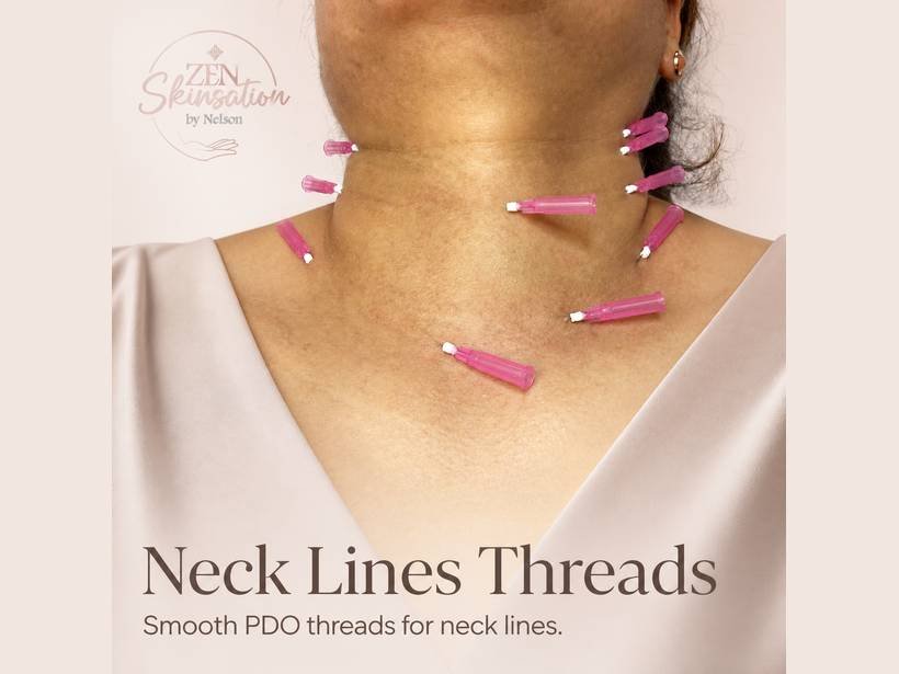 Neck Lines PDO Threads at Zenskinsation