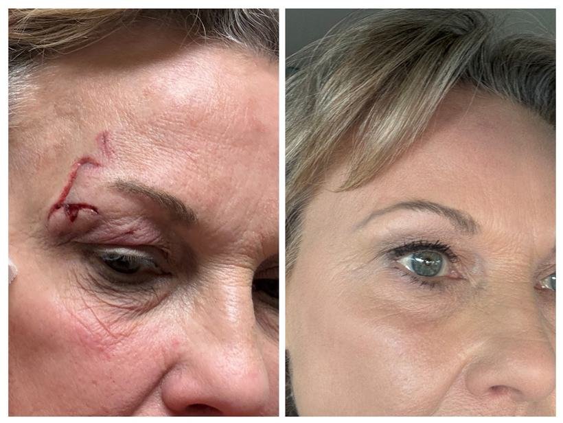 Before and after result — Zenskinsation