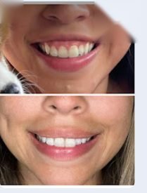 Before and after result — Zenskinsation