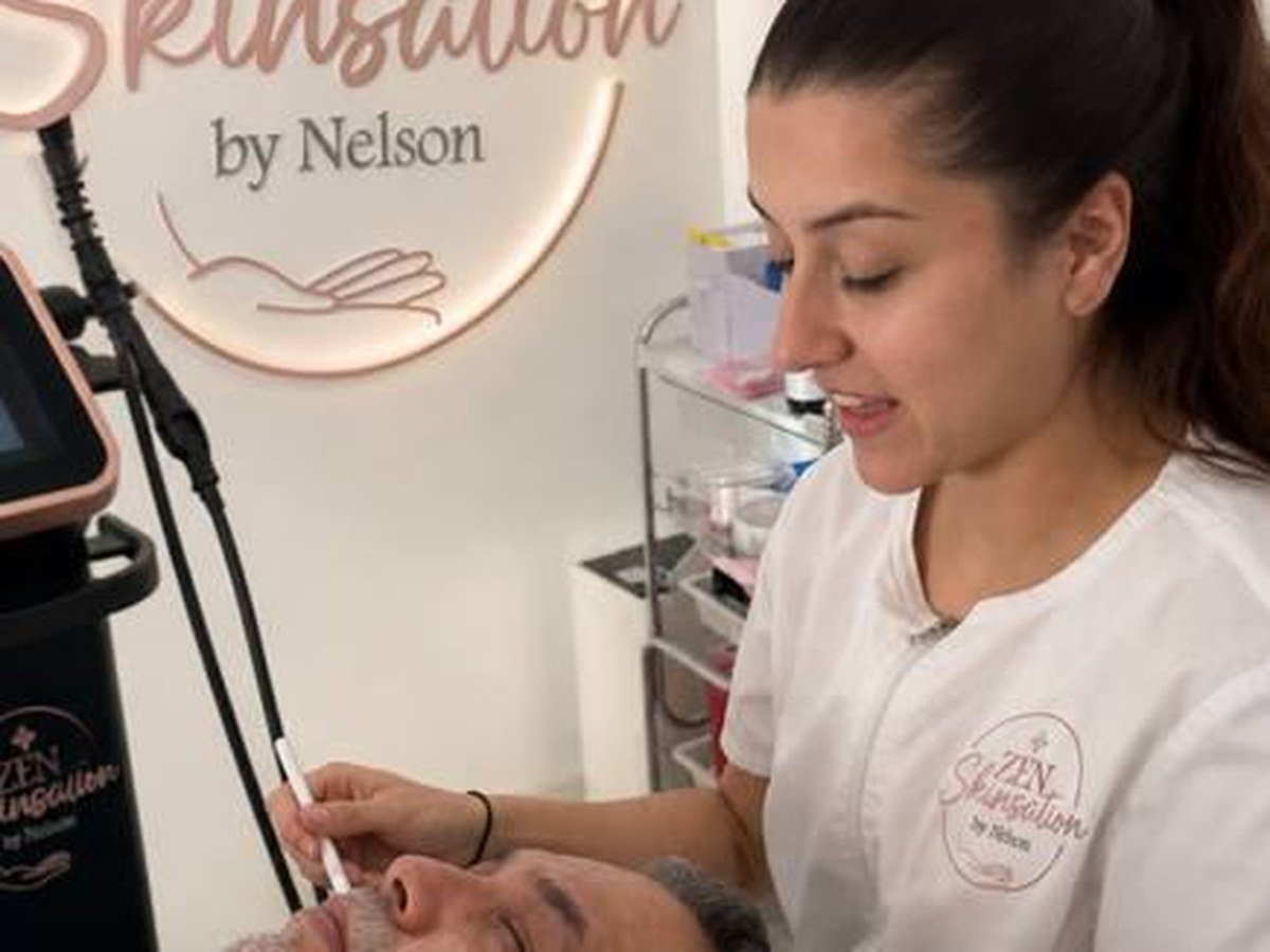 Microneedling y Plasma Channeling: cómo se trabaja la textura